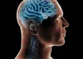 doença cerebral, condição neurológica, distúrbio cerebrospinal';