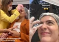 toxina, tratamento estético;