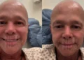 tumor, neoplasia, doença;