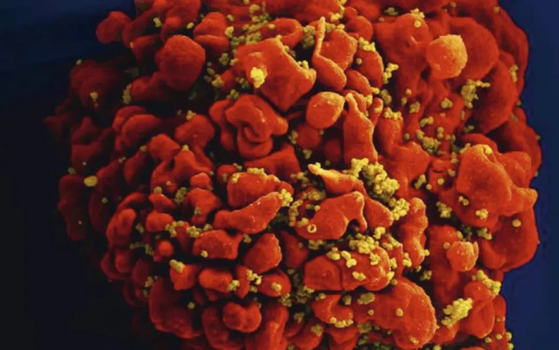 vírus da AIDS, infecção';